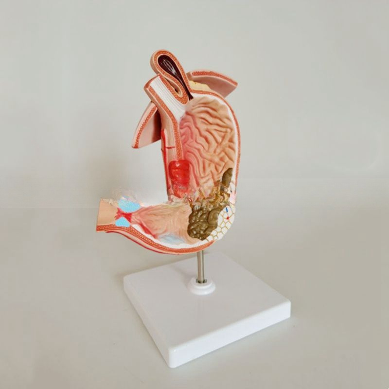 病理胃模型 医药教学与解剖学习的精密教具